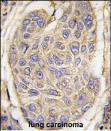 IHC-P - B2M Antibody (C-term) AP2771b